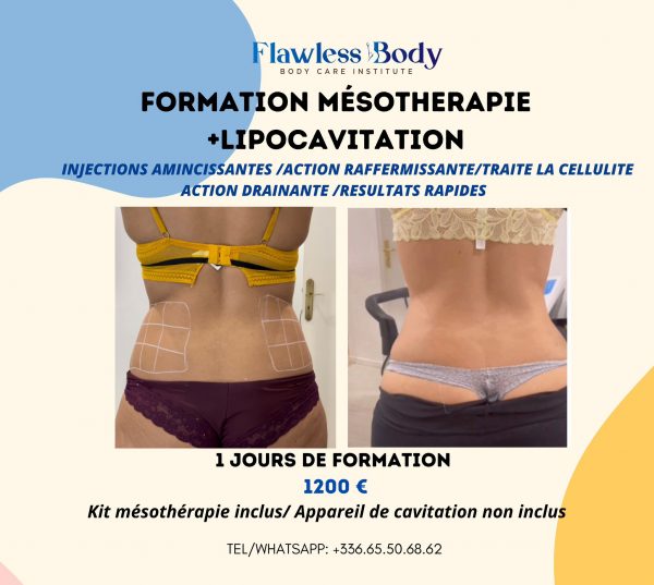 formation-meso-lipo