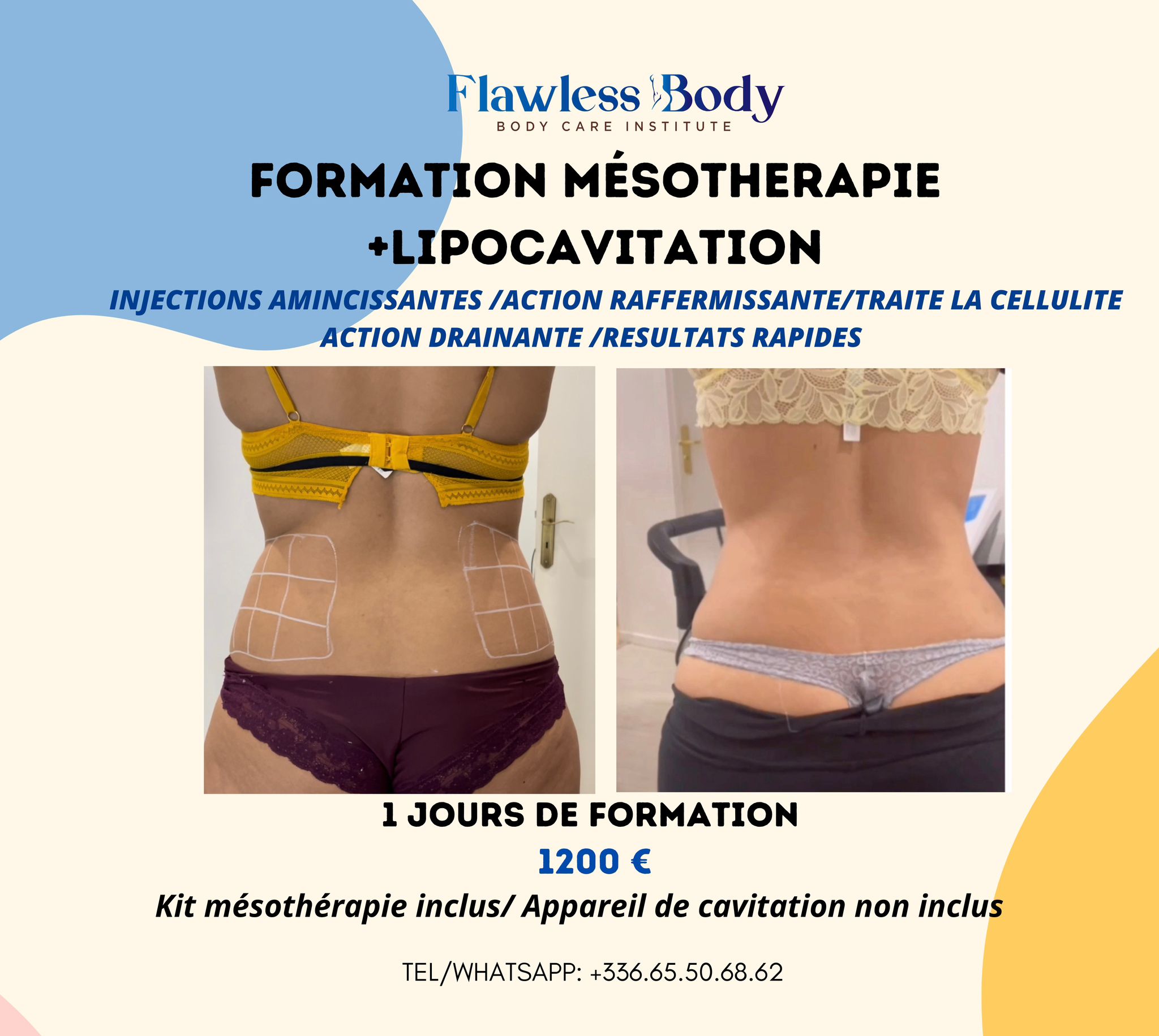 Formation Mésothérapie + Lipocavitation