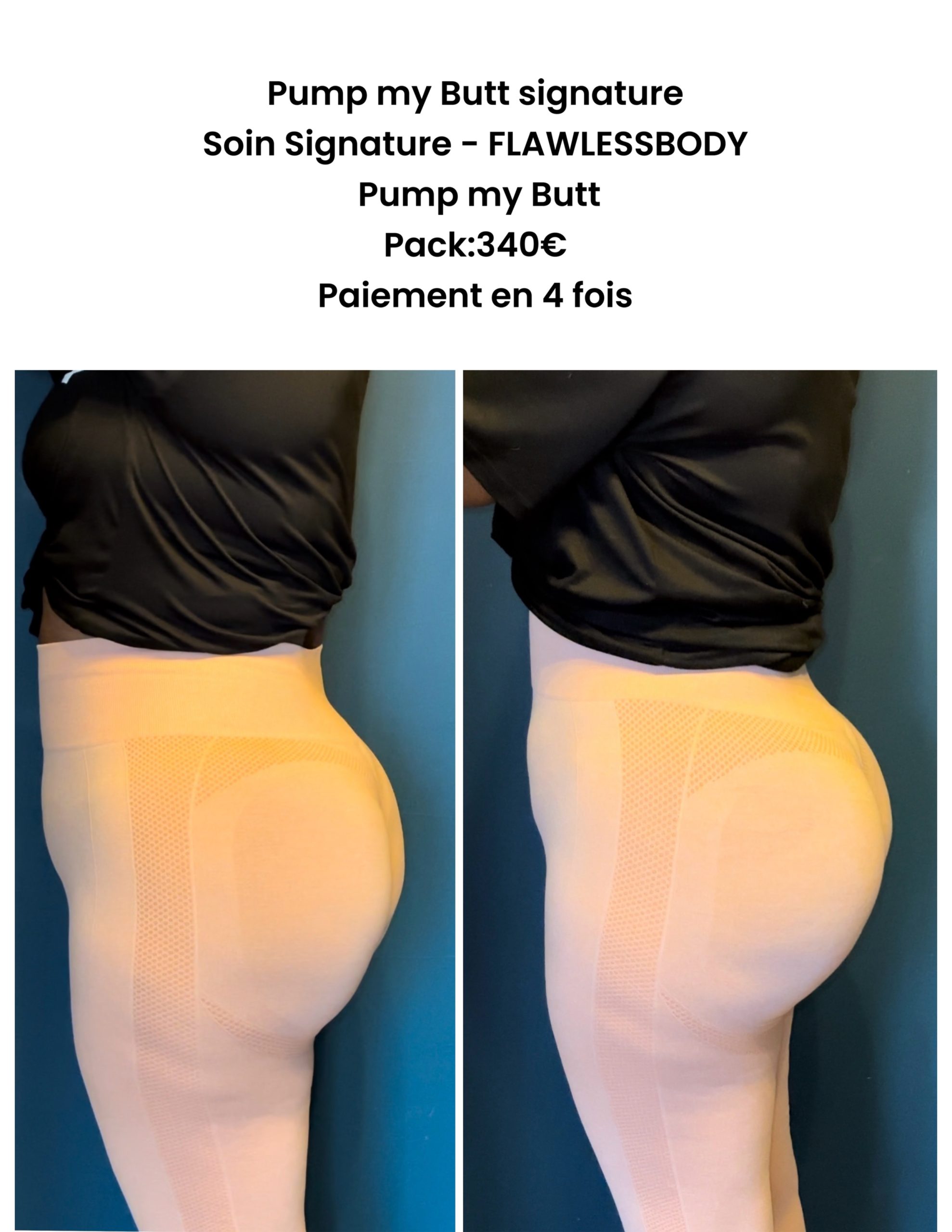 Soin Signature FLAWLESSBODY – Pump My Butt Pack 4 séances