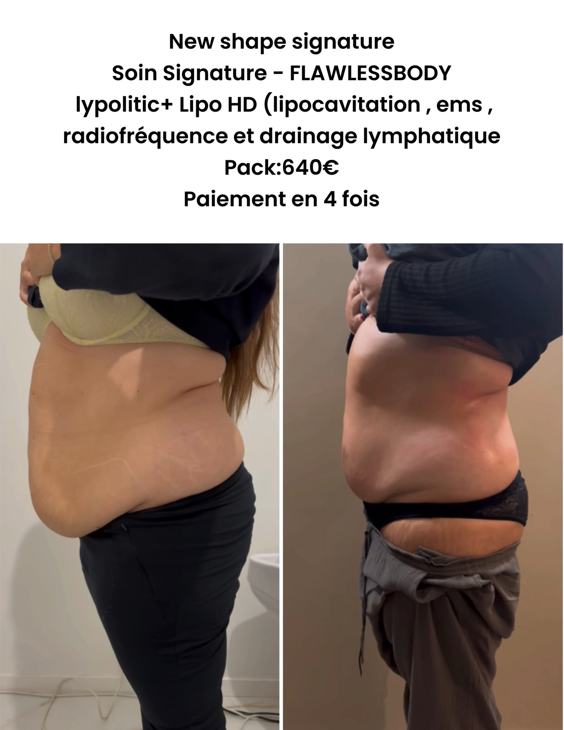 Soin Signature FLAWLESSBODY  – New Shape Pack 4 Séances