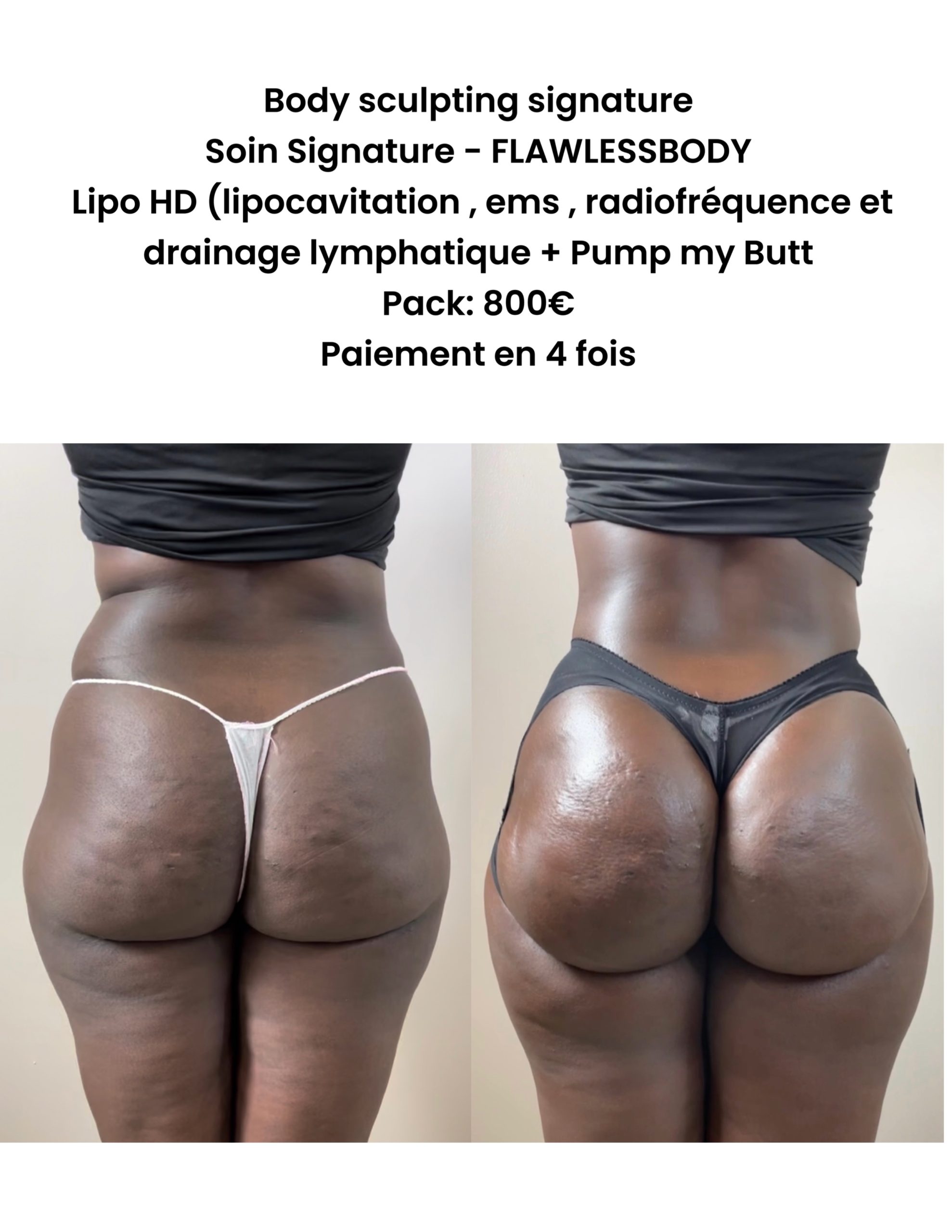 Soin Signature FLAWLESSBODY – Body Sculpting Pack 4 Séances
